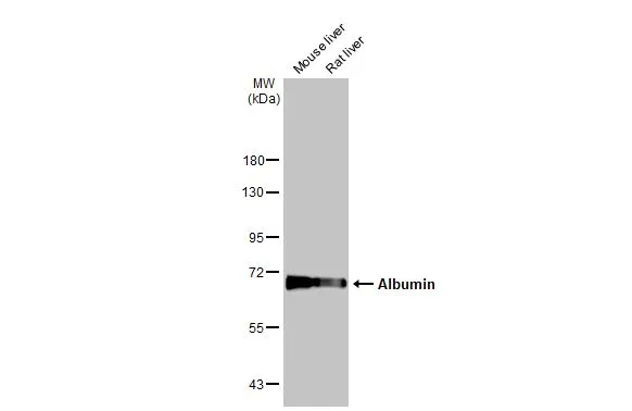 Various tissue extracts (50 μg) were separated by 7.5% SDS-PAGE, and the membrane was blotted with Albumin antibody (GTX102419) diluted at 1:1000. The HRP-conjugated anti-rabbit IgG antibody (GTX213110-01) was used to detect the primary antibody.