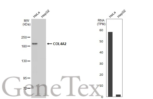 Various whole cell extracts (30 μg) were separated by 5% SDS-PAGE, and the membrane was blotted with COL4A2 antibody [N2N3] (GTX102422) diluted at 1:1000. The HRP-conjugated anti-rabbit IgG antibody (GTX213110-01) was used to detect the primary antibody, and the signal was developed with Trident ECL plus-Enhanced. Corresponding RNA expression data for the same cell lines are based on Human Protein Atlas program.
