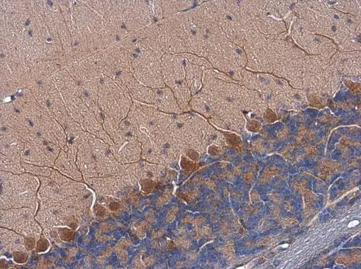 Anti-Tyrosine Hydroxylase antibody [N1C1] (GTX102424) | GeneTex