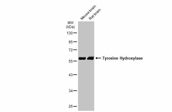 Mouse tissue extract (50 ug) was separated by 7.5% SDS-PAGE,and the membrane was blotted with Tyrosine Hydroxylase antibody [N1C1] (GTX102424) diluted at 1:1000.