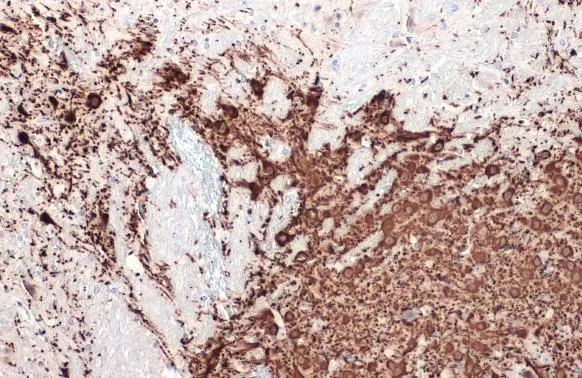 Anti-Tyrosine Hydroxylase antibody [N1C1] (GTX102424) | GeneTex