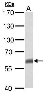 p63 antibody [N2C1], Internal detects TP63 protein by western blot analysis. A. 50 μg mouse brain lysate/extract 7.5% SDS-PAGE p63 antibody [N2C1], Internal (GTX102425) dilution: 1:500 The HRP-conjugated anti-rabbit IgG antibody (GTX213110-01) was used to detect the primary antibody.