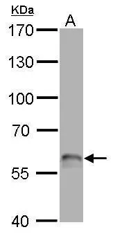 p63 antibody [N2C1], Internal detects TP63 protein by western blot analysis. A. 50 μg rat brain lysate/extract 7.5% SDS-PAGE p63 antibody [N2C1], Internal (GTX102425) dilution: 1:500 The HRP-conjugated anti-rabbit IgG antibody (GTX213110-01) was used to detect the primary antibody.