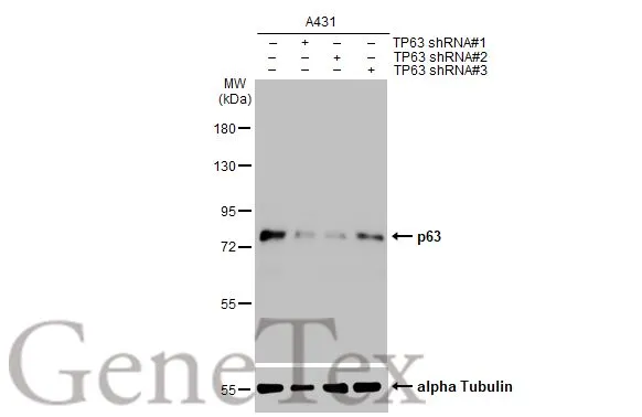 Non-transfected (–) and transfected (+) A431 whole cell extracts (30 μg) were separated by 7.5% SDS-PAGE, and the membrane was blotted with p63 antibody [N2C1], Internal (GTX102425) diluted at 1:2000. The HRP-conjugated anti-rabbit IgG antibody (GTX213110-01) was used to detect the primary antibody.