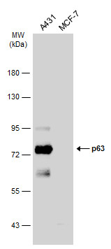 Various whole cell extracts (30 ug) were separated by 7.5% SDS-PAGE,and the membrane was blotted with p63 antibody [N2C1],Internal (GTX102425) diluted at 1:1000.
