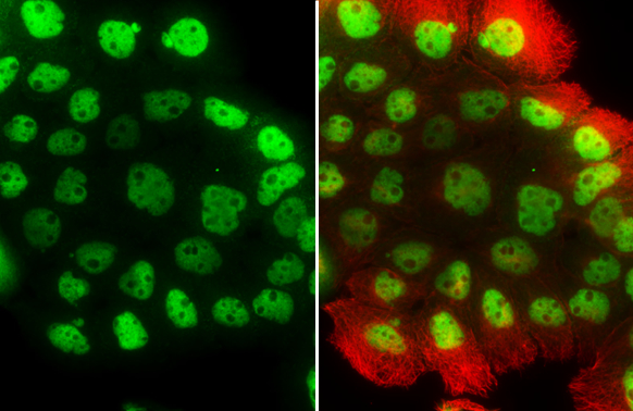 Various whole cell extracts (30 ug) were separated by 7.5% SDS-PAGE,and the membrane was blotted with p63 antibody [N2C1],Internal (GTX102425) diluted at 1:1000.