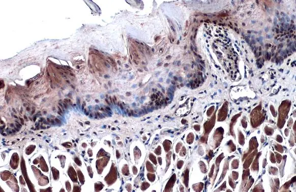Anti-p63 antibody [N2C1], Internal (GTX102425) | GeneTex