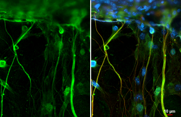 Cav2.2 antibody [C3], C-term detects Cav2.2 protein at cell membrane and nucleus by immunofluorescent analysis. Sample: mouse dorsal root ganglia cells were fixed in 4% paraformaldehyde at RT for 15 min. Green: Cav2.2 stained by Cav2.2 antibody [C3], C-term (GTX102449) diluted at 1:500. Red: NF-H, an axon marker, stained by NF-H antibody [GT114] (GTX634289) diluted at 1:500. Blue: Fluoroshield with DAPI (GTX30920).