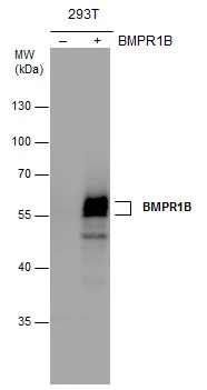 BMPR1B antibody detects BMPR1B protein by western blot analysis. Non-transfected (-) and BMPR1B-transfected (+, ) 293T whole cell extracts (30 μg) were separated by 10% SDS-PAGE, and the membrane was blotted with BMPR1B antibody (GTX102453) at a dilution of 1:5000. The HRP-conjugated anti-rabbit IgG antibody (GTX213110-01) was used to detect the primary antibody. BMPR1B antibody detects BMPR1B protein by western blot analysis. Non-transfected (-) and BMPR1B-transfected (+, ) 293T whole cell extracts (30 μg) were separated by 10% SDS-PAGE, and the membrane was blotted with BMPR1B antibody (GTX102453) at a dilution of 1:5000. The HRP-conjugated anti-rabbit IgG antibody (GTX213110-01) was used to detect the primary antibody.