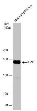Human tissue extract (30 μg) was separated by 5% SDS-PAGE, and the membrane was blotted with PZP antibody (GTX102547) diluted at 1:1000.