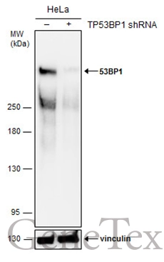 Non-transfected (–) and transfected (+) HeLa whole cell extracts (50 μg) were separated by 5% SDS-PAGE, and the membrane was blotted with 53BP1 antibody [N1], N-term (GTX102595) diluted at 1:500.