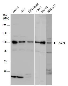 CD71 antibody detects CD71 protein by western blot analysis. Various whole cell extracts (30 μg) were separated by 7.5% SDS-PAGE, and the membrane was blotted with CD71 antibody (GTX102596) diluted at a dilution of 1:1000. The HRP-conjugated anti-rabbit IgG antibody (GTX213110-01) was used to detect the primary antibody.