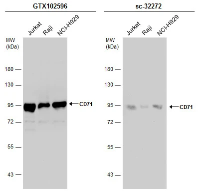 Various whole cell extracts (30 μg) were separated by 7.5% SDS-PAGE, and the membranes were blotted with CD71 antibody [N2C1], Internal (GTX102596) diluted at 1:1000 and competitor's antibody (sc-32272) diluted at 1:100. The HRP-conjugated anti-rabbit IgG antibody (GTX213110-01) was used to detect the primary antibody.