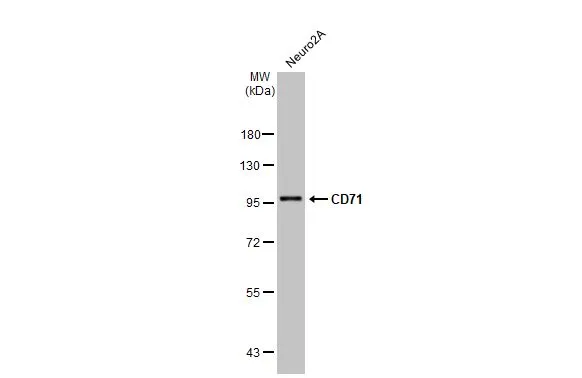Whole cell extract (30 μg) was separated by 7.5% SDS-PAGE, and the membrane was blotted with CD71 antibody [N2C1], Internal (GTX102596) diluted at 1:1000. The HRP-conjugated anti-rabbit IgG antibody (GTX213110-01) was used to detect the primary antibody.