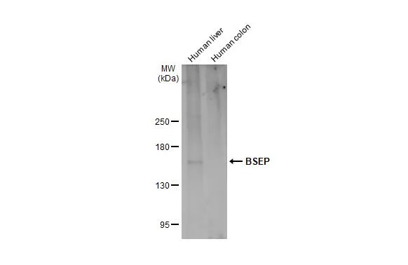 Various tissue extracts (5 μg) were separated by 5% SDS-PAGE, and the membrane was blotted with BSEP antibody [N3C1], Internal (GTX102608) diluted at 1:3000. The HRP-conjugated anti-rabbit IgG antibody (GTX213110-01) was used to detect the primary antibody, and the signal was developed with Trident ECL plus-Enhanced.
