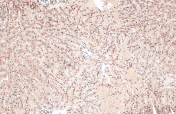 BSEP antibody [N3C1], Internal detects BSEP protein at cell membrane by immunohistochemical analysis. Sample: Paraffin-embedded mouse liver. BSEP stained by BSEP antibody [N3C1], Internal (GTX102608) diluted at 1:500. Antigen Retrieval: Citrate buffer, pH 6.0, 15 min