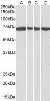 WB analysis of NIH-3T3 (A),HeLa (B),A431 (C) and Jurkat (D) nuclear lysates using GTX10261 DDX5 antibody,C-term. Dilution : 0.3ug/ml Loading : 35ug protein in RIPA buffer