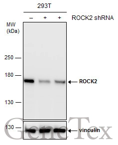 Non-transfected (–) and transfected (+) 293T whole cell extracts (30 μg) were separated by 5% SDS-PAGE, and the membrane was blotted with ROCK2 antibody (GTX102619) diluted at 1:2000.