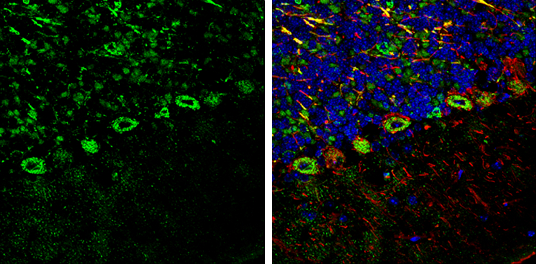 ROCK2 antibody detects ROCK2 protein expression by immunohistochemical analysis. Sample: Frozen-sectioned adult mouse cerebellum. Green: ROCK2 protein stained by ROCK2 antibody (GTX102619) diluted at 1:250. Red: NF-H, stained by NF-H antibody [GT114] (GTX634289) diluted at 1:500. Blue: Fluoroshield with DAPI (GTX30920). 
 Antigen Retrieval: Citrate buffer, pH 6.0, 10 min