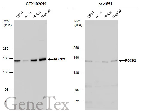Various whole cell extracts (30 μg) were separated by 5% SDS-PAGE, and the membranes were blotted with ROCK2 antibody (GTX102619) diluted at 1:1000 and competitor's antibody (sc-1851) diluted at 1:100. The HRP-conjugated anti-rabbit IgG antibody (GTX213110-01) was used to detect the primary antibody. *The competitor is not affiliated with GeneTex and does not endorse this product.