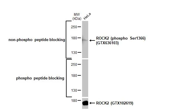 Whole cell extract (30 μg) was separated by 5% SDS-PAGE, and the membrane was blotted with ROCK2 antibody (GTX102619) diluted at 1:1000. The HRP-conjugated anti-rabbit IgG antibody (GTX213110-01) was used to detect the primary antibody, and the signal was developed with Trident ECL plus-Enhanced.