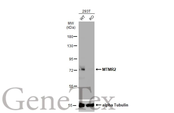 Wild-type (WT) and MTMR2 knockout (KO) HeLa cell extracts (30 μg) were separated by 7.5% SDS-PAGE, and the membrane was blotted with MTMR2 antibody [C1C3] (GTX102633) diluted at 1:1000. The HRP-conjugated anti-rabbit IgG antibody (GTX213110-01) was used to detect the primary antibody, and the signal was developed with Trident ECL plus-Enhanced.