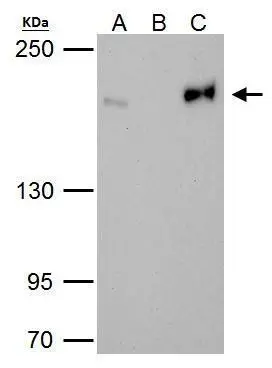 Topoisomerase II beta antibody [C3],C-term detects Topoisomerase II beta protein at nucleus by immunofluorescent analysis.