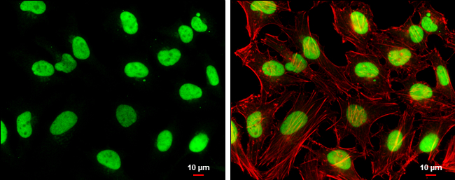 Topoisomerase II beta antibody [C3], C-term detects Topoisomerase II beta protein at nucleus by immunofluorescent analysis. Sample: HeLa cells were fixed in 4% paraformaldehyde at RT for 15 min. Green: Topoisomerase II beta stained by Topoisomerase II beta antibody [C3], C-term (GTX102640) diluted at 1:500. Red: phalloidin, a cytoskeleton marker, diluted at 1:100. Scale bar= 10 μm.