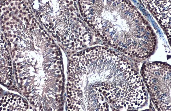 Topoisomerase II beta antibody [C3], C-term detects Topoisomerase II beta protein at nucleus by immunohistochemical analysis. Sample: Paraffin-embedded mouse testis. Topoisomerase II beta stained by Topoisomerase II beta antibody [C3], C-term (GTX102640) diluted at 1:500. Antigen Retrieval: Citrate buffer, pH 6.0, 15 min