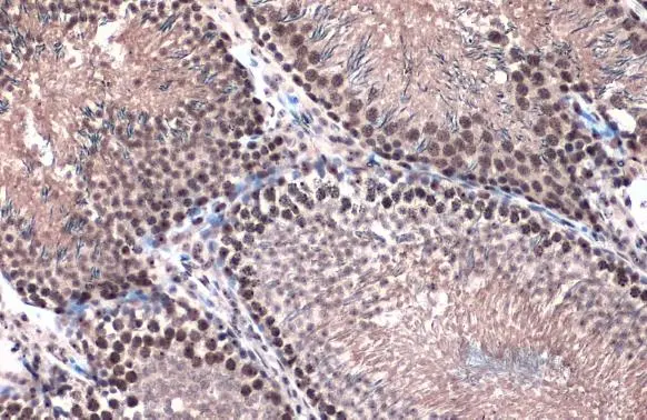 Topoisomerase II beta antibody [C3], C-term detects Topoisomerase II beta protein at nucleus by immunohistochemical analysis. Sample: Paraffin-embedded rat testis. Topoisomerase II beta stained by Topoisomerase II beta antibody [C3], C-term (GTX102640) diluted at 1:500. Antigen Retrieval: Citrate buffer, pH 6.0, 15 min