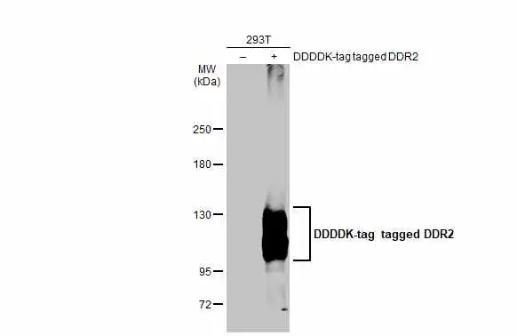 Non-transfected (–) and transfected (+) 293T whole cell extracts (30 μg) were separated by 5% SDS-PAGE, and the membrane was blotted with DDR2 antibody [C2C3], C-term (GTX102651) diluted at 1:3000. The HRP-conjugated anti-rabbit IgG antibody (GTX213110-01) was used to detect the primary antibody.