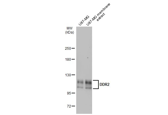 U87-MG whole cell and membrane extracts (30 μg) were separated by 5% SDS-PAGE, and the membrane was blotted with DDR2 antibody [C2C3], C-term (GTX102651) diluted at 1:1000. The HRP-conjugated anti-rabbit IgG antibody (GTX213110-01) was used to detect the primary antibody.