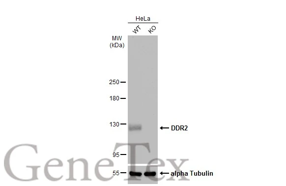 Wild-type (WT) and DDR2 (KO) HeLa cell extracts (30 μg) were separated by 5% SDS-PAGE, and the membrane was blotted with DDR2 antibody [C2C3], C-term (GTX102651) diluted at 1:1000. The HRP-conjugated anti-rabbit IgG antibody (GTX213110-01) was used to detect the primary antibody.