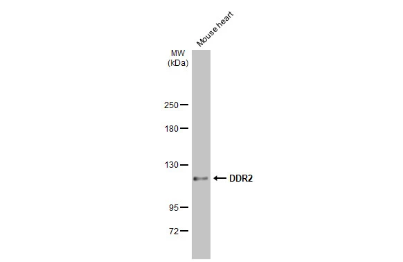 Mouse tissue extract (50 μg) was separated by 5% SDS-PAGE, and the membrane was blotted with DDR2 antibody [C2C3], C-term (GTX102651) diluted at 1:1000. The HRP-conjugated anti-rabbit IgG antibody (GTX213110-01) was used to detect the primary antibody.