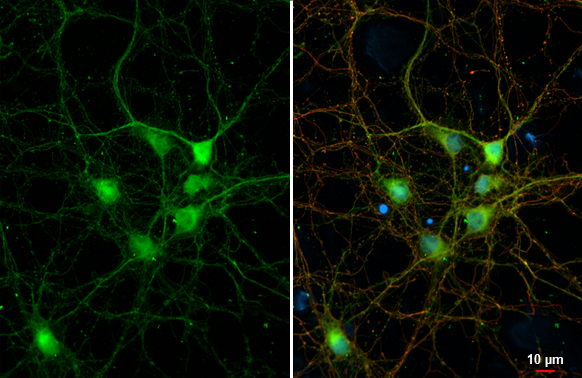 DDR2 antibody [C2C3], C-term detects DDR2 protein at cell membrane by immunofluorescent analysis. Sample: DIV9 rat E18 primary cortical neuron and glia cells were fixed in 4% paraformaldehyde at RT for 15 min. Green: DDR2 stained by DDR2 antibody [C2C3], C-term (GTX102651) diluted at 1:250. Red: Tau, an Axon marker, stained by Tau antibody [GT287] (GTX634809) diluted at 1:500. Blue: Fluoroshield with DAPI (GTX30920).