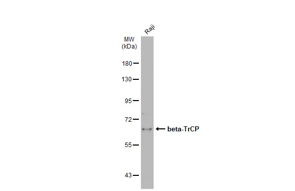 Whole cell extract (30 μg) was separated by 7.5% SDS-PAGE, and the membrane was blotted with beta-TrCP antibody [N1C1] (GTX102667) diluted at 1:500. The HRP-conjugated anti-rabbit IgG antibody (GTX213110-01) was used to detect the primary antibody.