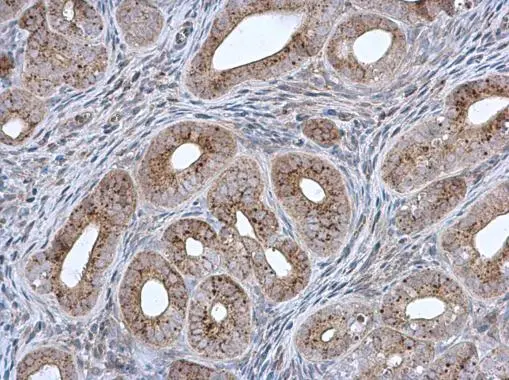 MCCC2 antibody [N1C1]