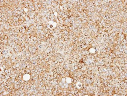 Immunohistochemical analysis of paraffin-embedded SW480 xenograft,using MCCC2(GTX102674) antibody at 1:100 dilution. Antigen Retrieval: Citrate buffer,pH 6.0,15 min