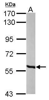 MCCC2 antibody [N1C1]