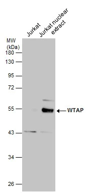 Jurkat whole cell and nuclear extracts (30 μg) were separated by 10% SDS-PAGE, and the membrane was blotted with WTAP antibody (GTX102708) diluted at 1:500.