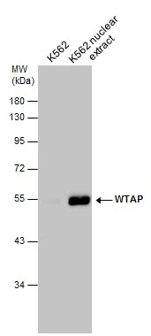 K562 whole cell and nuclear extracts (30 μg) were separated by 10% SDS-PAGE, and the membrane was blotted with WTAP antibody (GTX102708) diluted at 1:500. K562 whole cell and nuclear extracts (30 μg) were separated by 10% SDS-PAGE, and the membrane was blotted with WTAP antibody (GTX102708) diluted at 1:500.