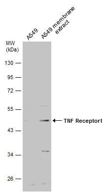 A549 whole cell and membrane extracts (30 μg) were separated by 10% SDS-PAGE, and the membrane was blotted with TNF Receptor I antibody (GTX102710) diluted at 1:500.