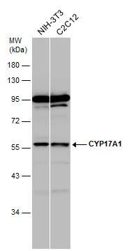 Various whole cell extracts (30 μg) were separated by 10% SDS-PAGE, and the membrane was blotted with CYP17A1 antibody [N1C2] (GTX102753) diluted at 1:1000.