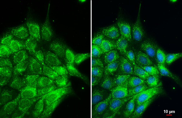 Cytokeratin 2 antibody detects Cytokeratin 2 protein at cytoplasm by immunofluorescent analysis. Sample: MDCK cells were fixed in 4% paraformaldehyde at RT for 15 min. Green: Cytokeratin 2 stained by Cytokeratin 2 antibody (GTX102758) diluted at 1:500.