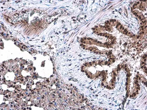 DCK antibody detects DCK protein at nucleus by immunohistochemical analysis. Sample: Paraffin-embedded rat lung. DCK stained by DCK antibody (GTX102800) diluted at 1:500.
 Antigen Retrieval: Citrate buffer, pH 6.0, 15 min