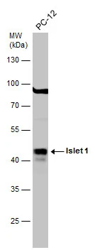 Whole cell extract (30 μg) was separated by 10% SDS-PAGE, and the membrane was blotted with Islet 1 antibody (GTX102807) diluted at 1:1000. The HRP-conjugated anti-rabbit IgG antibody (GTX213110-01) was used to detect the primary antibody.