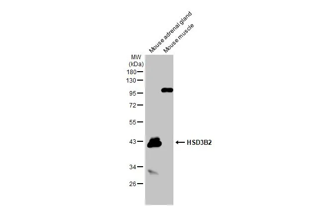 Mouse tissue extract (50 μg) were separated by 10% SDS-PAGE, and the membrane was blotted with HSD3B2 antibody [N3C3] (GTX102813) diluted at 1:1000. The HRP-conjugated anti-rabbit IgG antibody (GTX213110-01) was used to detect the primary antibody.