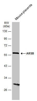 Mouse tissue extract (50 μg) was separated by 10% SDS-PAGE, and the membrane was blotted with ARSB antibody (GTX102829) diluted at 1:500. The HRP-conjugated anti-rabbit IgG antibody (GTX213110-01) was used to detect the primary antibody.
