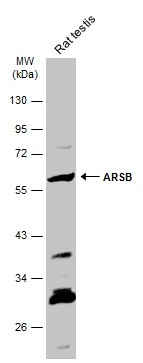 Rat tissue extract (50 μg) was separated by 10% SDS-PAGE, and the membrane was blotted with ARSB antibody (GTX102829) diluted at 1:500. The HRP-conjugated anti-rabbit IgG antibody (GTX213110-01) was used to detect the primary antibody.