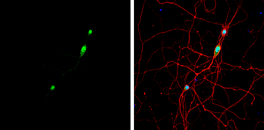 NOVA1 antibody detects NOVA1 protein by immunofluorescent analysis. Sample: DIV9 rat E18 primary hippocampal neuron cells were fixed in 4% paraformaldehyde at RT for 15 min. Green: NOVA1 stained by NOVA1 antibody (GTX102831) diluted at 1:500. Red: beta Tubulin 3/ Tuj1, stained by beta Tubulin 3/ Tuj1 antibody [GT11710] (GTX631836) diluted at 1:500. Blue: Fluoroshield with DAPI (GTX30920).